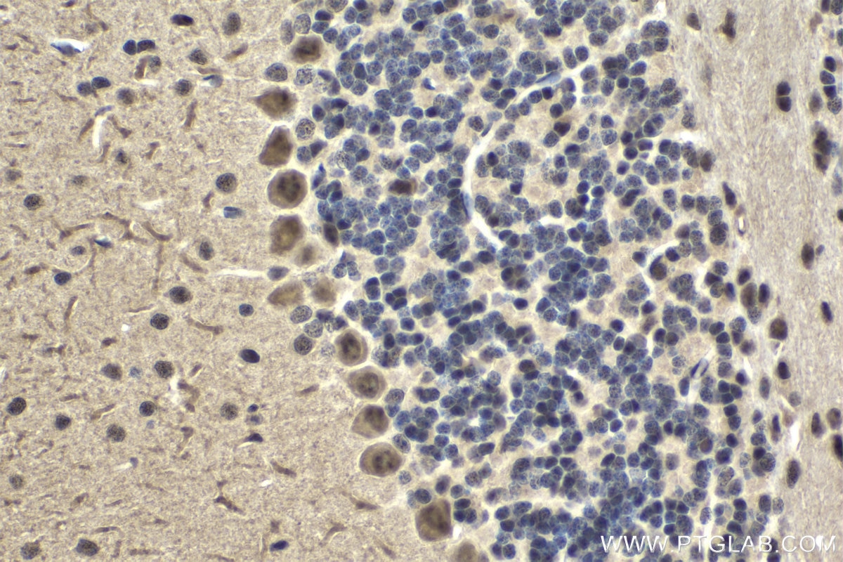 Immunohistochemical analysis of paraffin-embedded mouse cerebellum tissue slide using KHC1712 (NFATC2 IHC Kit).