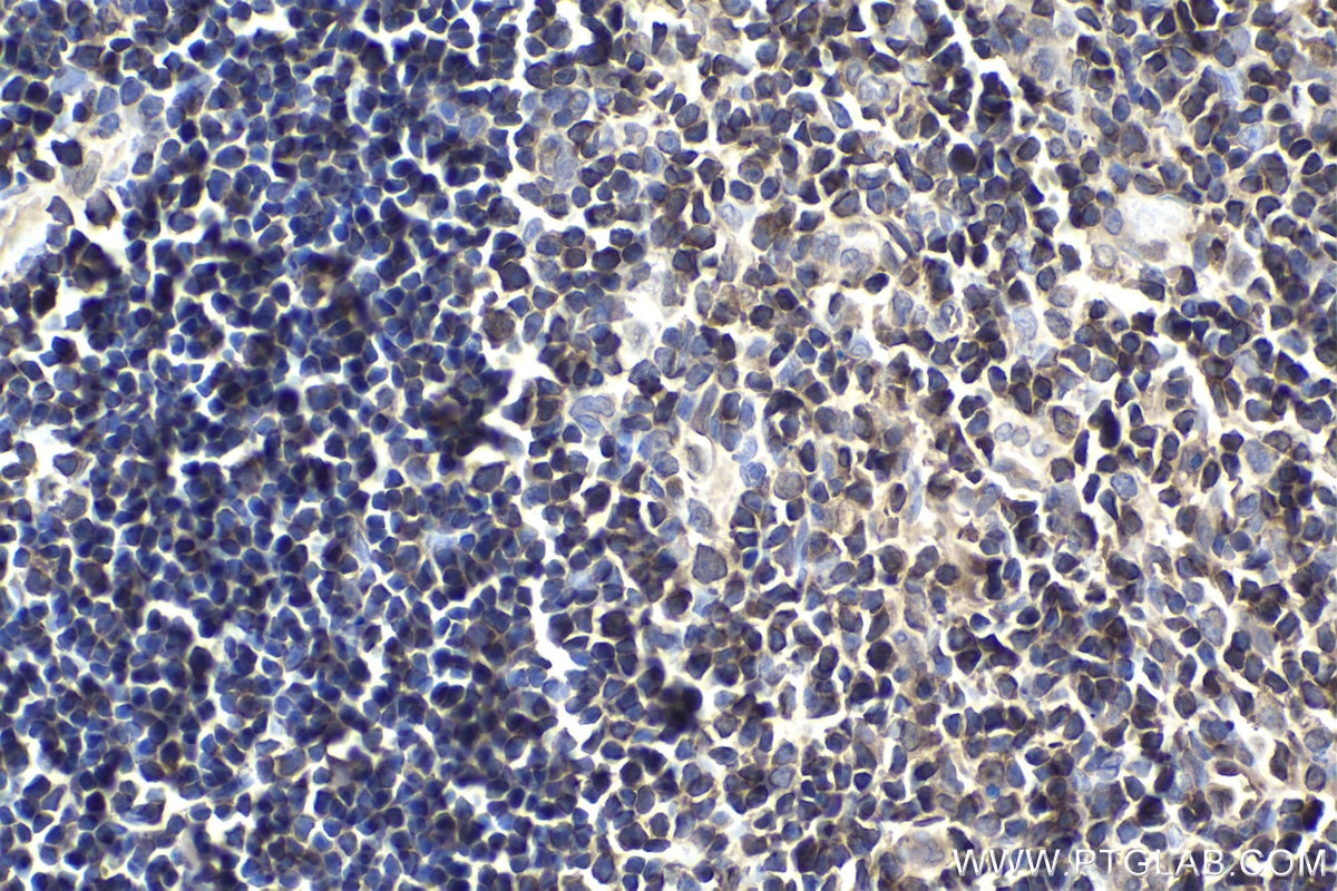 Immunohistochemical analysis of paraffin-embedded rat thymus tissue slide using KHC1696 (NFATC3 IHC Kit).