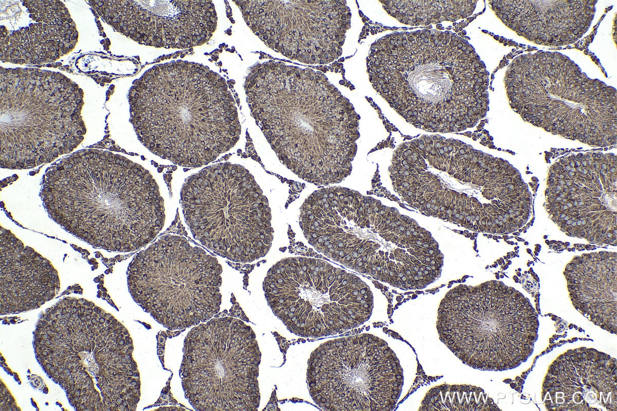 Immunohistochemical analysis of paraffin-embedded rat testis tissue slide using KHC1696 (NFATC3 IHC Kit).