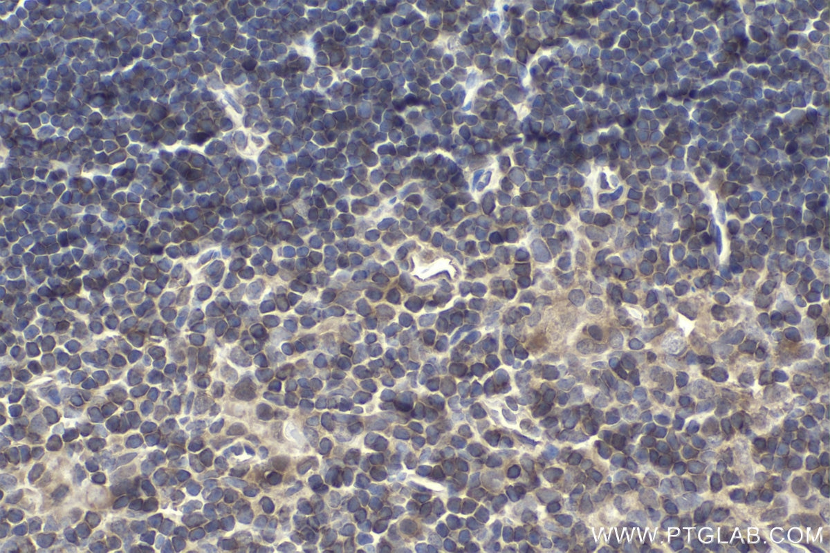 Immunohistochemical analysis of paraffin-embedded mouse thymus tissue slide using KHC1696 (NFATC3 IHC Kit).