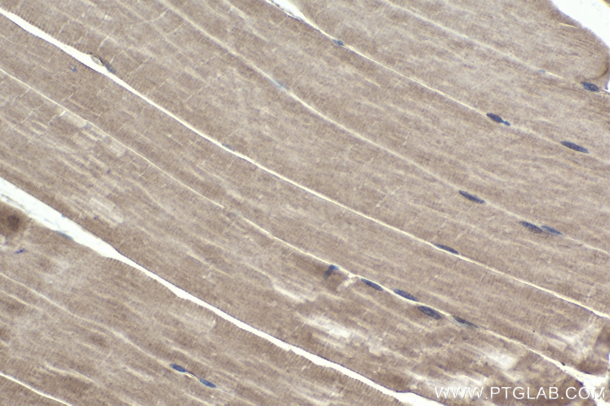 Immunohistochemical analysis of paraffin-embedded mouse skeletal muscle tissue slide using KHC1696 (NFATC3 IHC Kit).