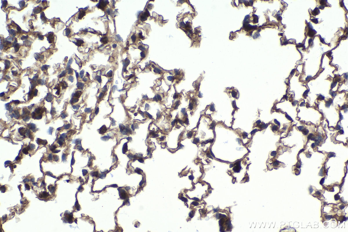 Immunohistochemical analysis of paraffin-embedded mouse lung tissue slide using KHC1740 (NFATC4 IHC Kit).