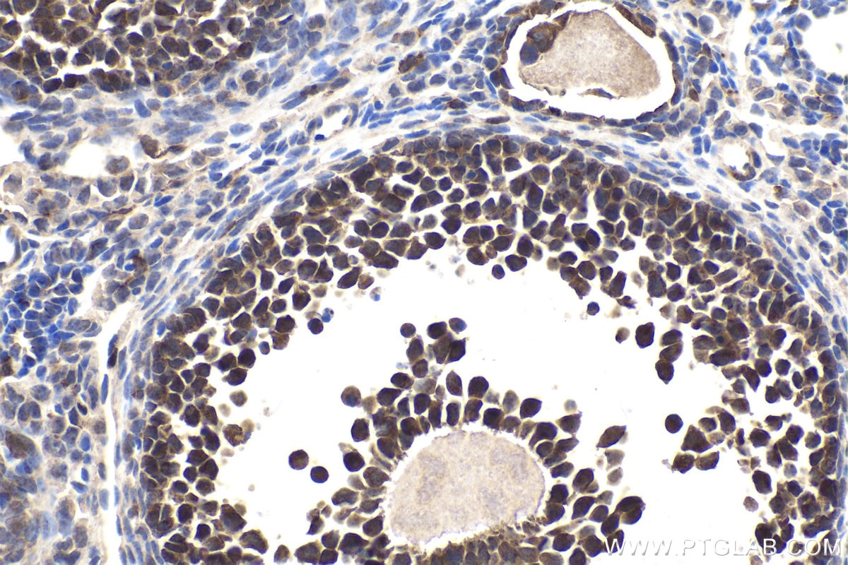 Immunohistochemical analysis of paraffin-embedded mouse ovary tissue slide using KHC1740 (NFATC4 IHC Kit).