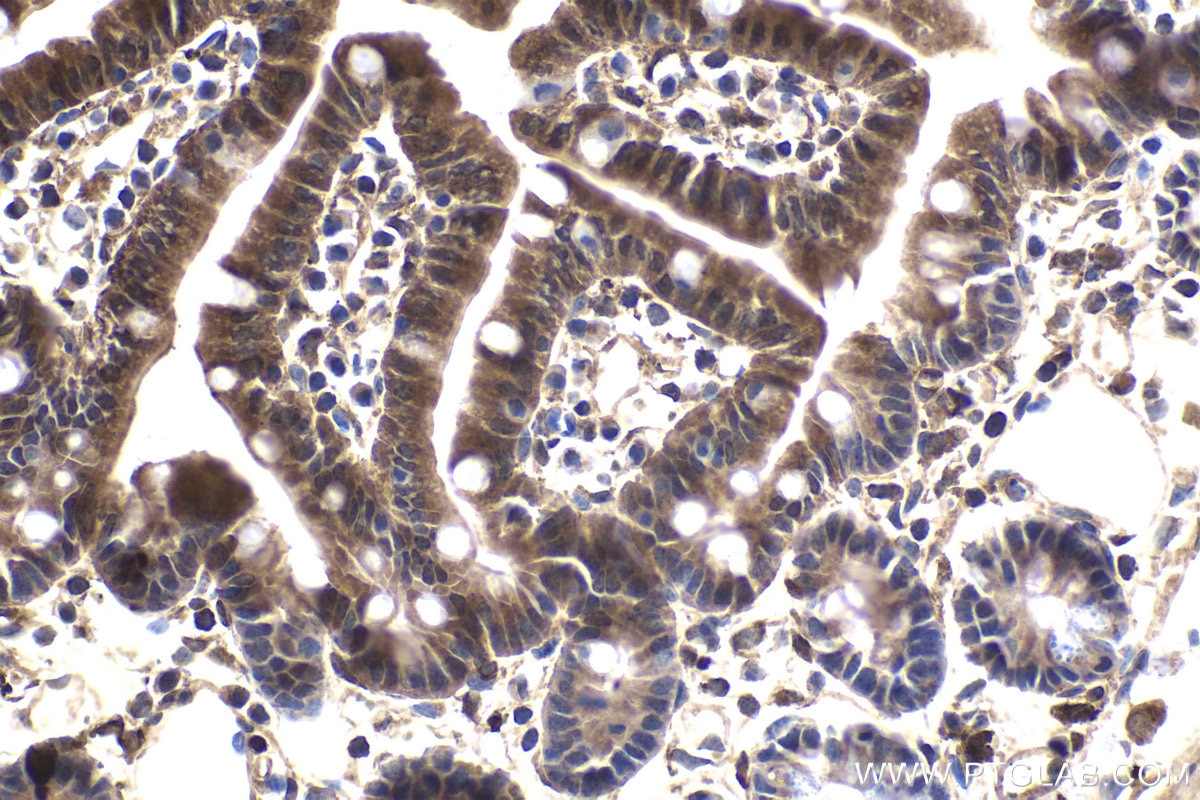 Immunohistochemical analysis of paraffin-embedded mouse small intestine tissue slide using KHC1740 (NFATC4 IHC Kit).