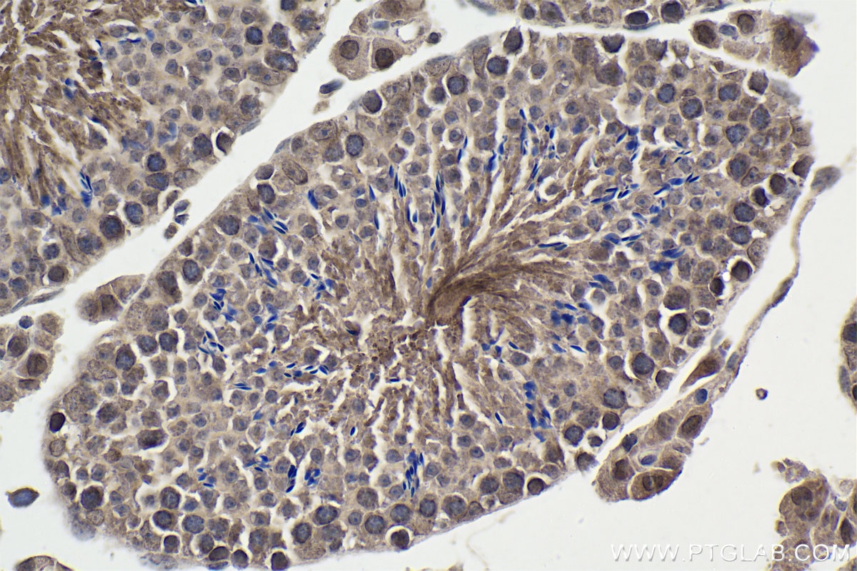 Immunohistochemical analysis of paraffin-embedded mouse testis tissue slide using KHC1761 (NFE2 IHC Kit).