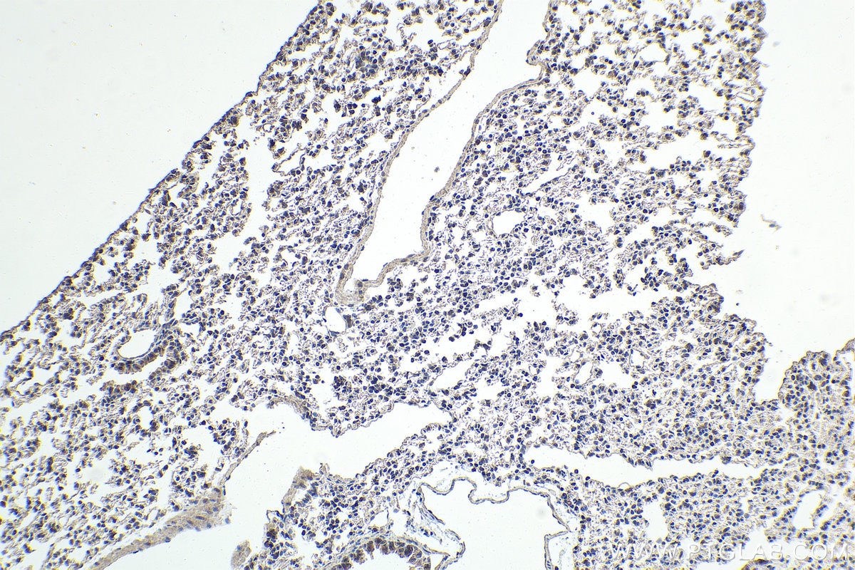 Immunohistochemical analysis of paraffin-embedded mouse lung tissue slide using KHC1761 (NFE2 IHC Kit).