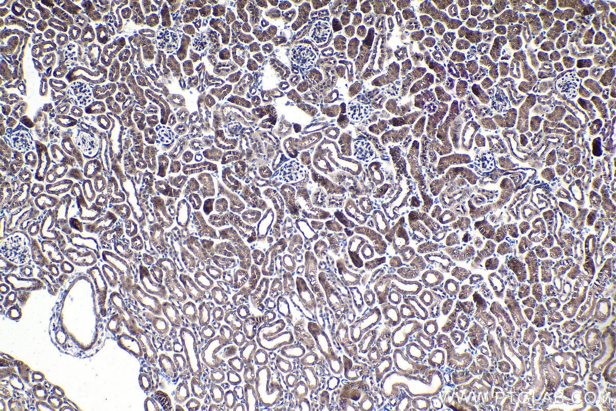 Immunohistochemical analysis of paraffin-embedded mouse kidney tissue slide using KHC1065 (NFE2L2/NRF2 IHC Kit).