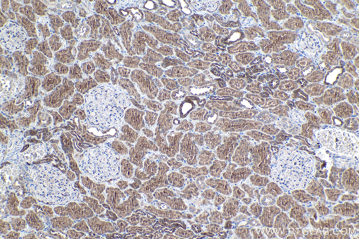 Immunohistochemical analysis of paraffin-embedded human kidney tissue slide using KHC1065 (NFE2L2/NRF2 IHC Kit).