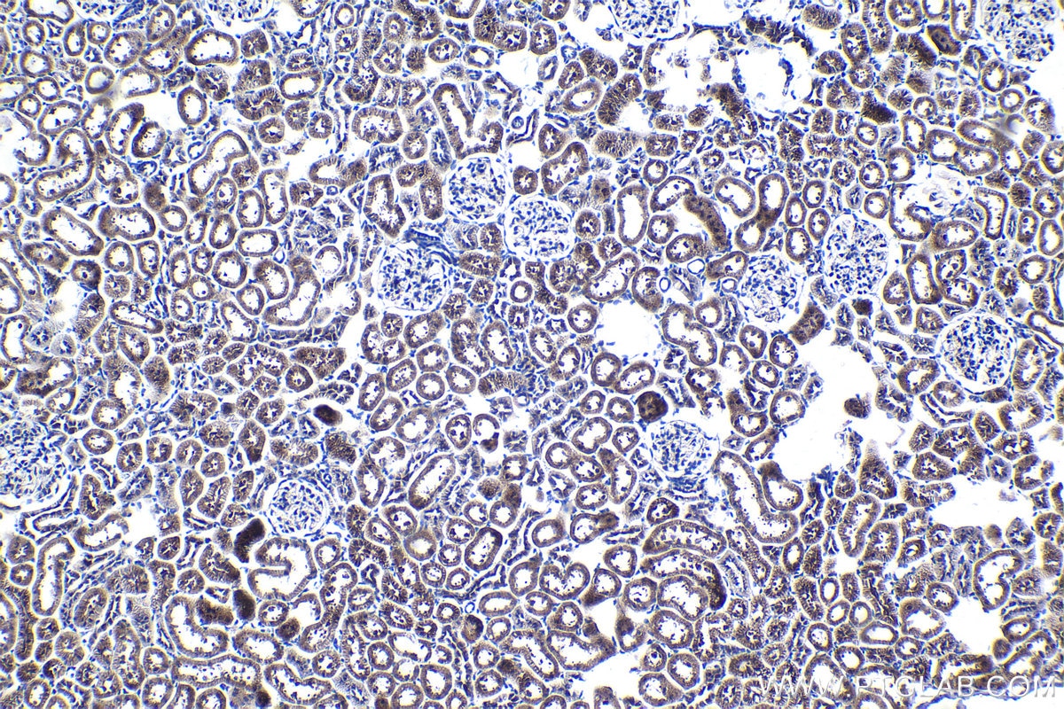 Immunohistochemical analysis of paraffin-embedded rat kidney tissue slide using KHC1065 (NFE2L2/NRF2 IHC Kit).