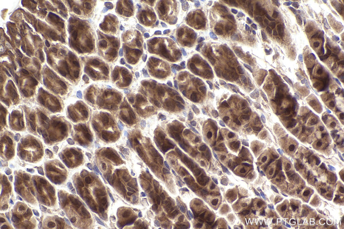 Immunohistochemical analysis of paraffin-embedded mouse stomach tissue slide using KHC2502 (NFE2L2/NRF2 IHC Kit). Immunohistochemical analysis of paraffin-embedded mouse stomach tissue slide using KHC2502 (NFE2L2/NRF2 IHC Kit).