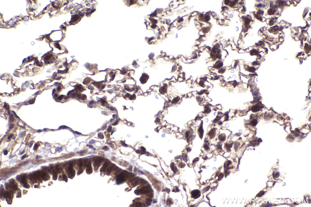 Immunohistochemical analysis of paraffin-embedded rat lung tissue slide using KHC2502 (NFE2L2/NRF2 IHC Kit). Immunohistochemical analysis of paraffin-embedded rat lung tissue slide using KHC2502 (NFE2L2/NRF2 IHC Kit).