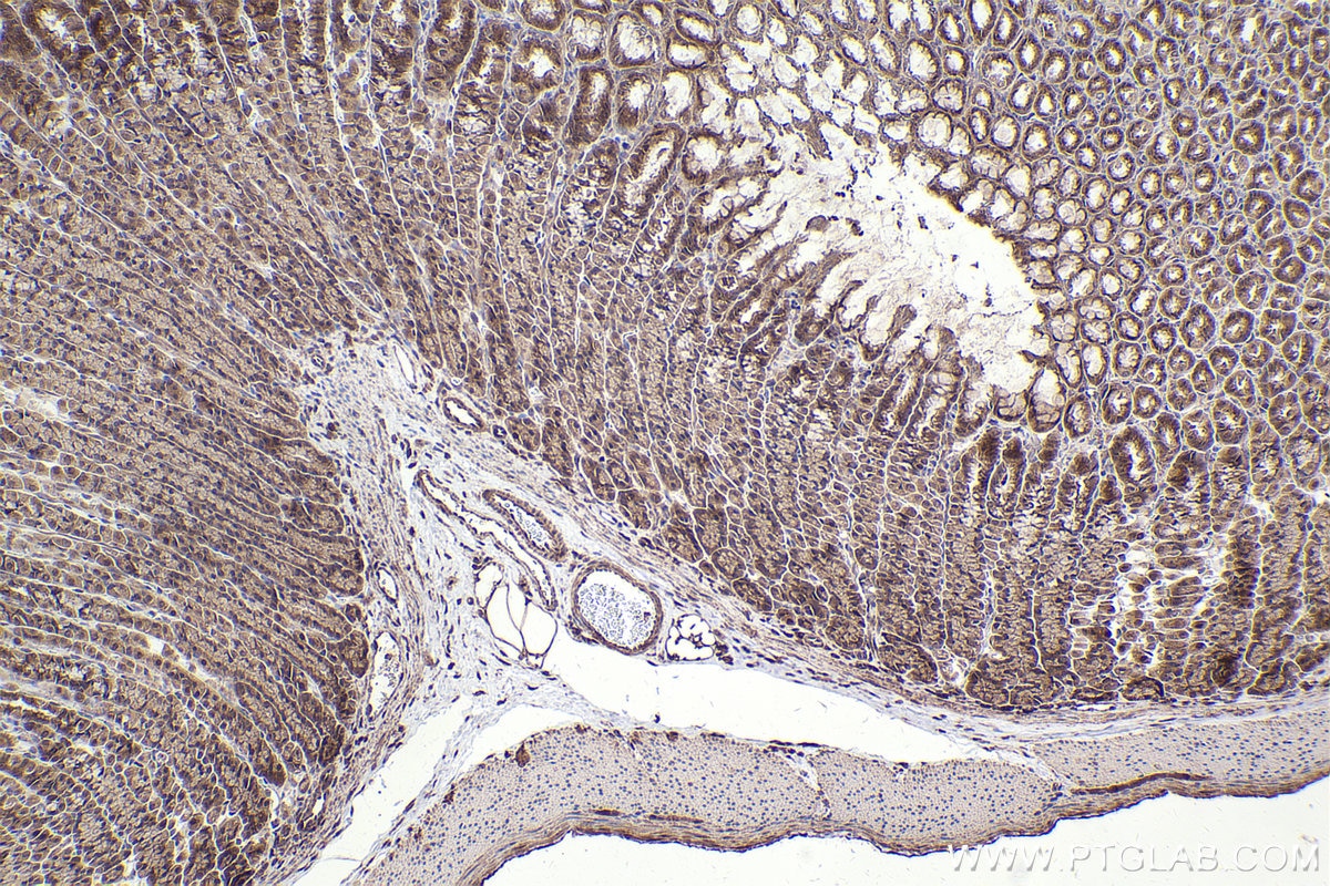 Immunohistochemical analysis of paraffin-embedded rat stomach tissue slide using KHC2502 (NFE2L2/NRF2 IHC Kit). Immunohistochemical analysis of paraffin-embedded rat stomach tissue slide using KHC2502 (NFE2L2/NRF2 IHC Kit).