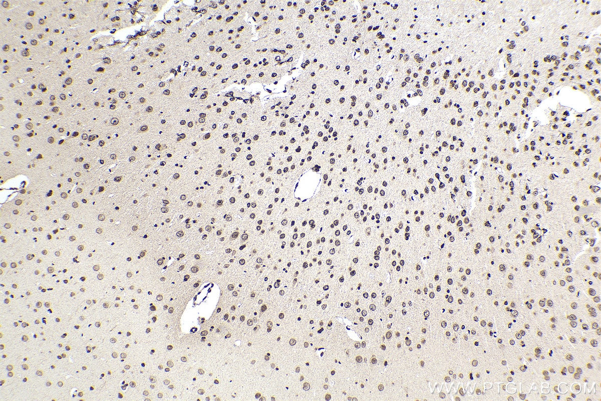 Immunohistochemical analysis of paraffin-embedded mouse brain tissue slide using KHC1693 (NFIA IHC Kit).