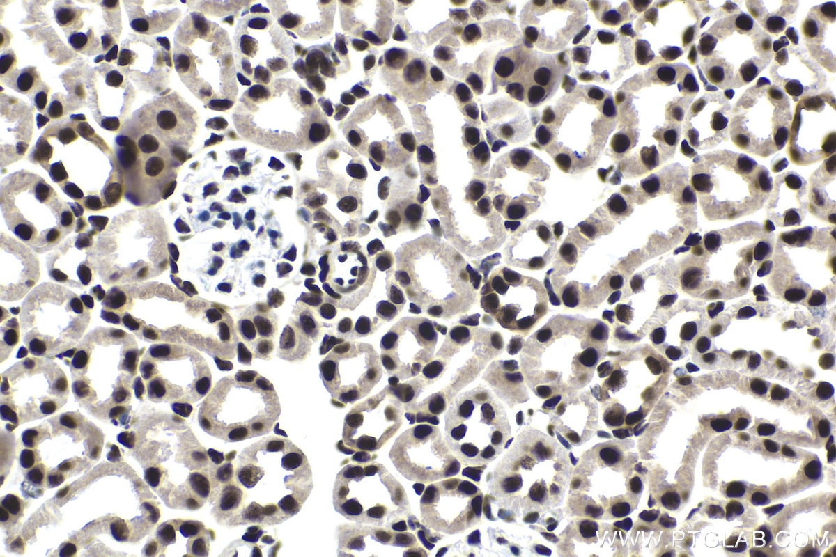 Immunohistochemical analysis of paraffin-embedded mouse kidney tissue slide using KHC1693 (NFIA IHC Kit).