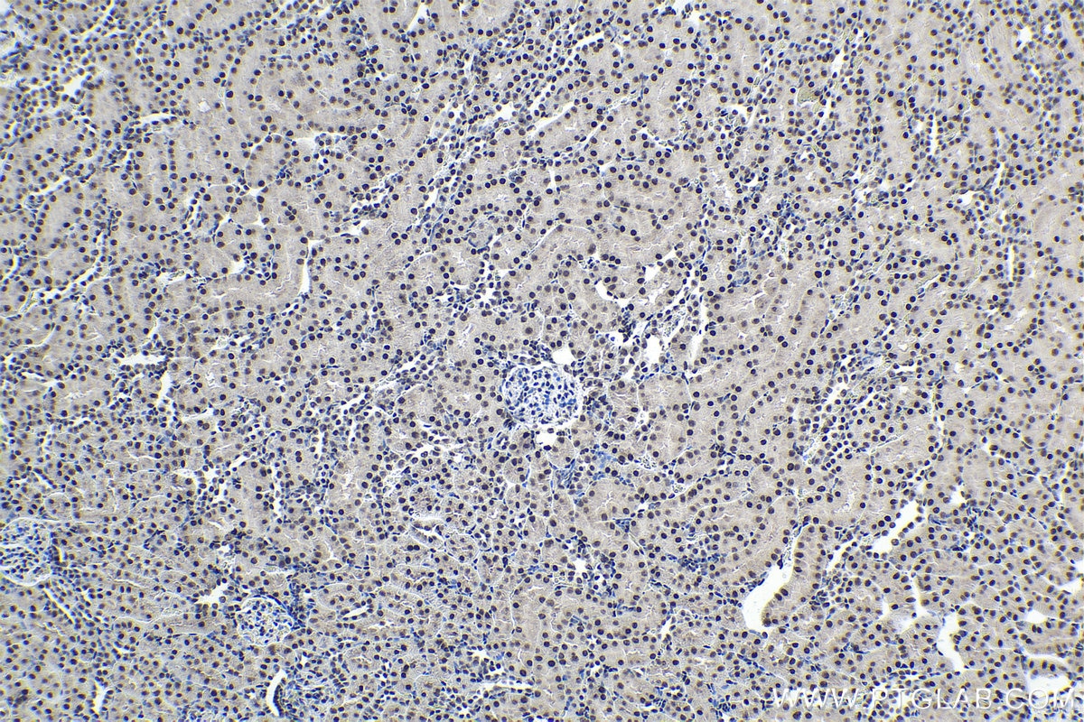 Immunohistochemical analysis of paraffin-embedded rat kidney tissue slide using KHC1693 (NFIA IHC Kit).