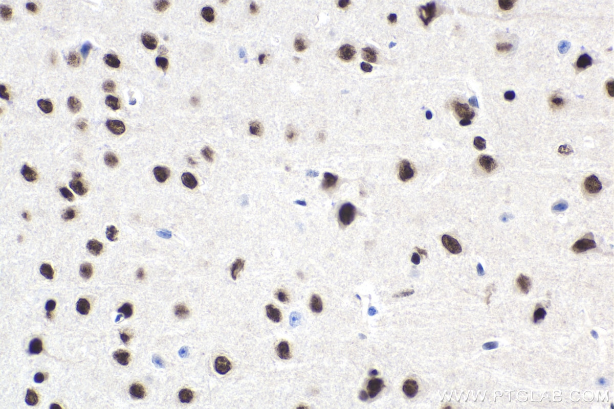 Immunohistochemical analysis of paraffin-embedded mouse brain tissue slide using KHC1741 (NFIX IHC Kit).