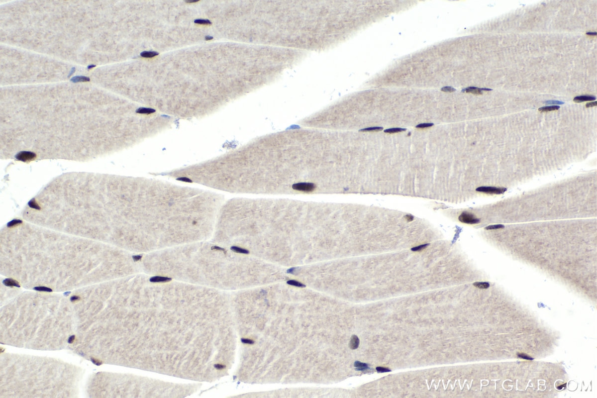 Immunohistochemical analysis of paraffin-embedded mouse skeletal muscle tissue slide using KHC1741 (NFIX IHC Kit).