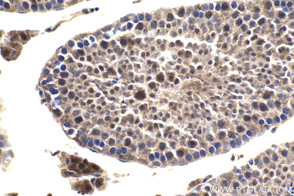 Immunohistochemical analysis of paraffin-embedded mouse testis tissue slide using KHC1659 (NFKB2 IHC Kit).