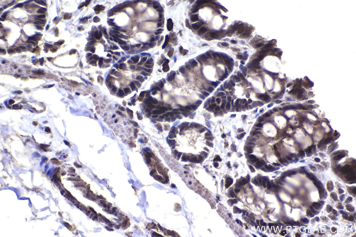 Immunohistochemical analysis of paraffin-embedded rat colon tissue slide using KHC1368 (NFKBIA IHC Kit).