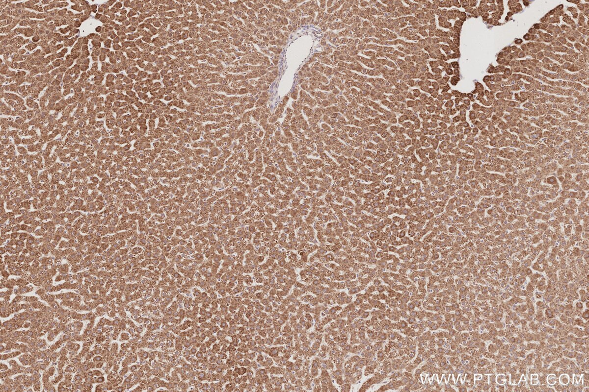 Immunohistochemical analysis of paraffin-embedded rat liver tissue slide using KHC3085 (NFS1 IHC Kit). Immunohistochemical analysis of paraffin-embedded rat liver tissue slide using KHC3085 (NFS1 IHC Kit).