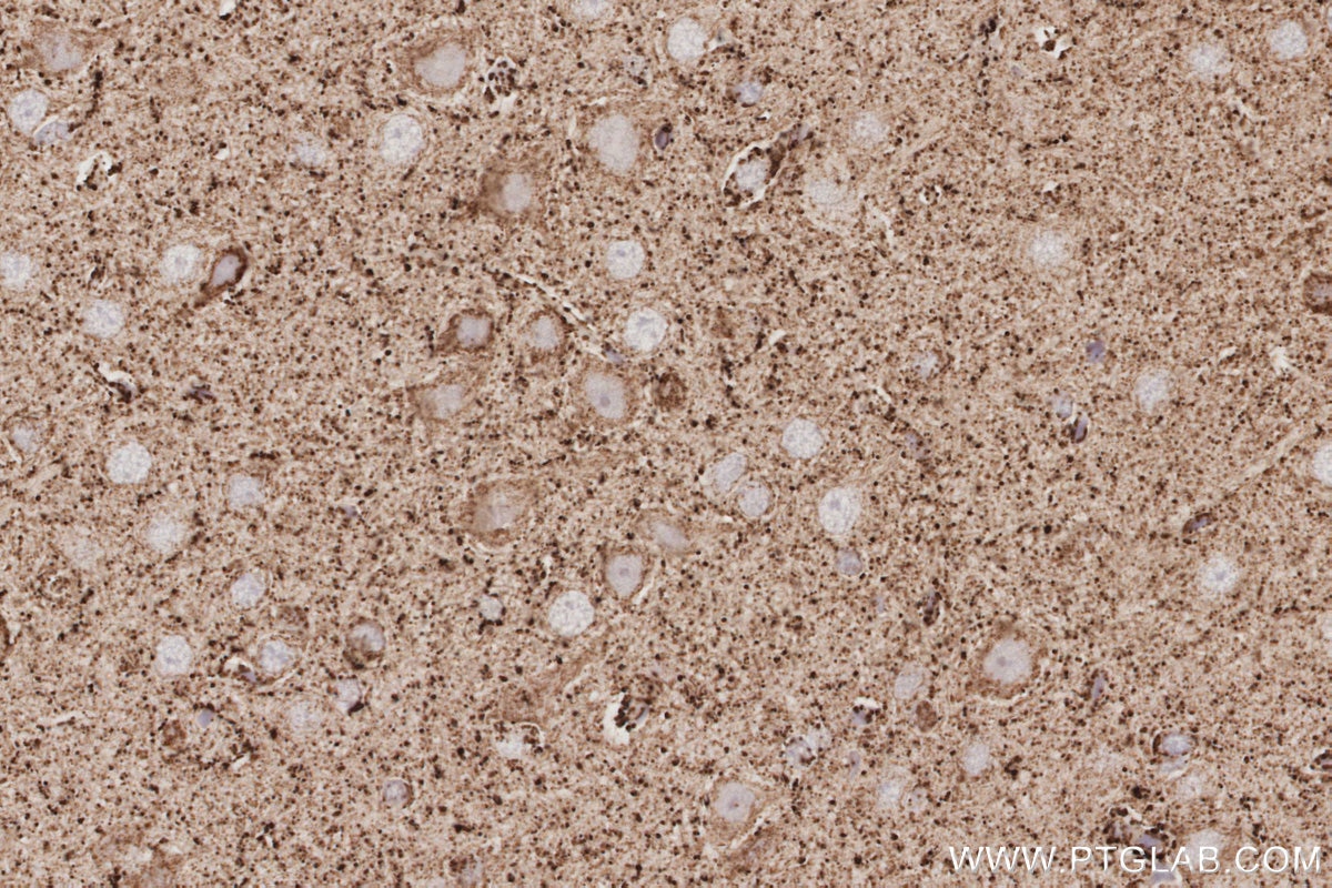 Immunohistochemical analysis of paraffin-embedded rat brain tissue slide using KHC3085 (NFS1 IHC Kit). Immunohistochemical analysis of paraffin-embedded rat brain tissue slide using KHC3085 (NFS1 IHC Kit).
