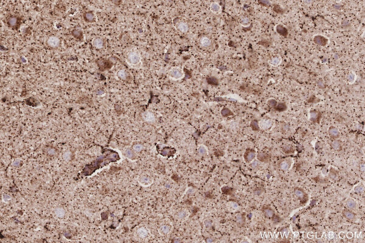 Immunohistochemical analysis of paraffin-embedded mouse brain tissue slide using KHC3085 (NFS1 IHC Kit). Immunohistochemical analysis of paraffin-embedded mouse brain tissue slide using KHC3085 (NFS1 IHC Kit).