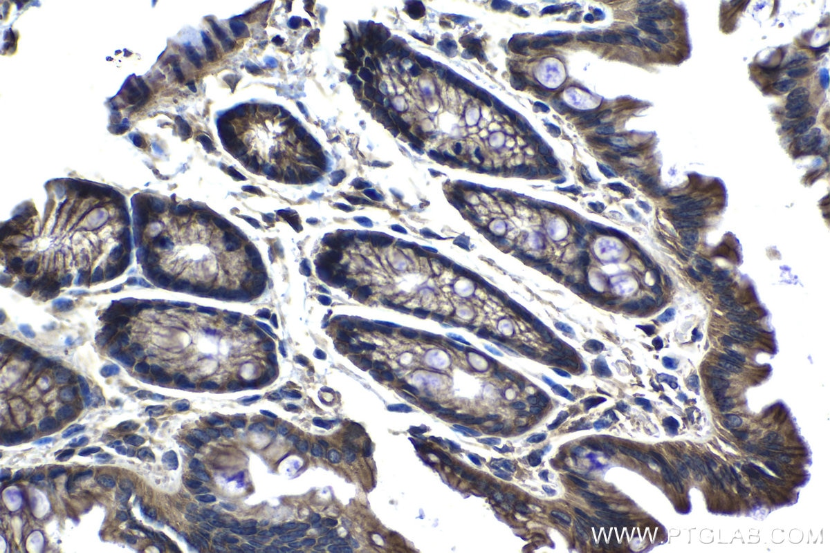 Immunohistochemical analysis of paraffin-embedded mouse colon tissue slide using KHC1288 (NHE1/SLC9A1 IHC Kit).