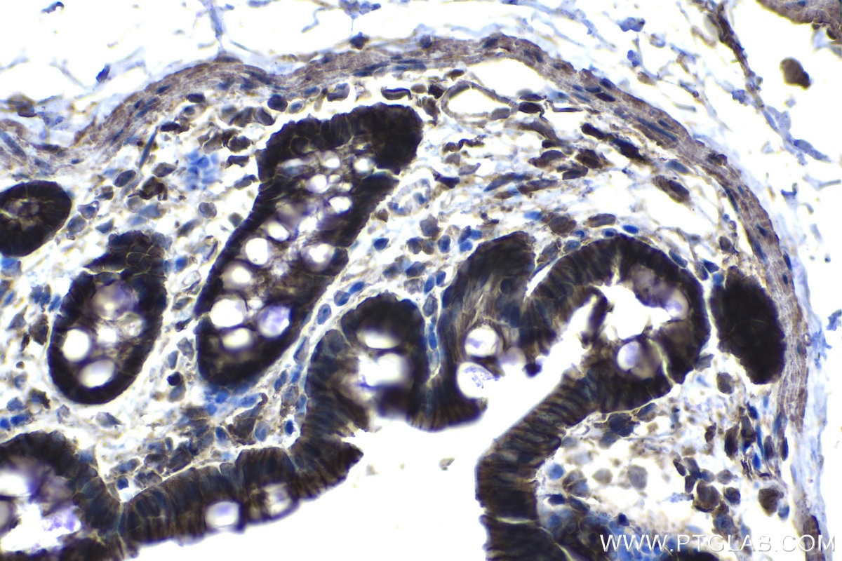 Immunohistochemical analysis of paraffin-embedded rat colon tissue slide using KHC1288 (NHE1/SLC9A1 IHC Kit).