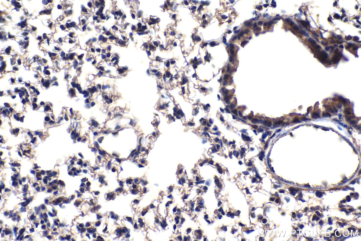 Immunohistochemical analysis of paraffin-embedded mouse lung tissue slide using KHC1919 (NIF3L1 IHC Kit).