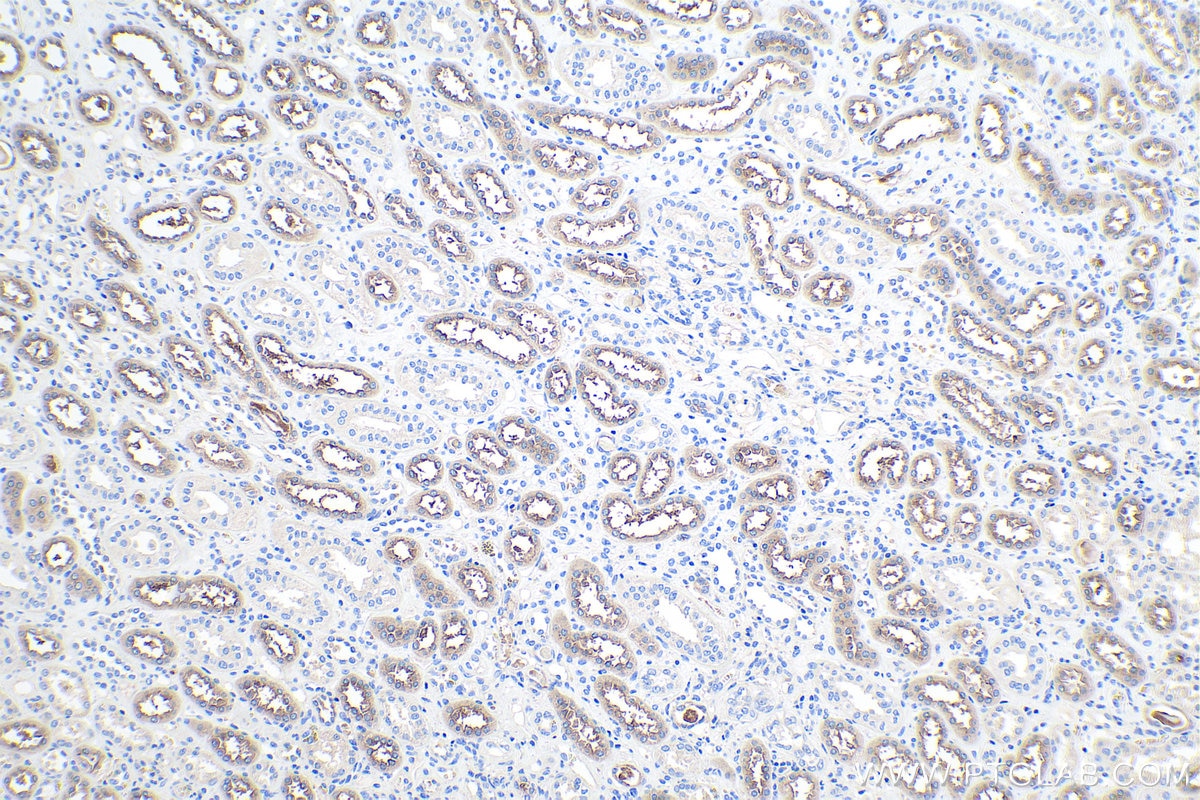 Immunohistochemical analysis of paraffin-embedded human kidney tissue slide using KHC0189 (NKCC2 IHC Kit).