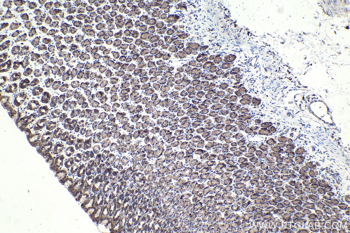 Immunohistochemical analysis of paraffin-embedded rat stomach tissue slide using KHC1913 (NLRP1 IHC Kit).