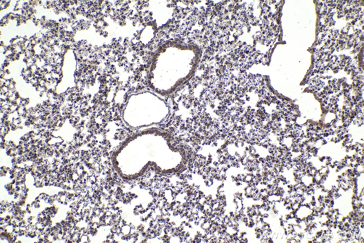Immunohistochemical analysis of paraffin-embedded mouse lung tissue slide using KHC1913 (NLRP1 IHC Kit).