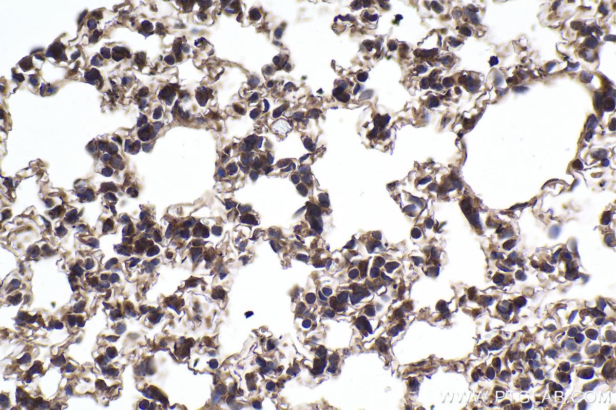 Immunohistochemical analysis of paraffin-embedded mouse lung tissue slide using KHC1881 (NLRP3 IHC Kit).