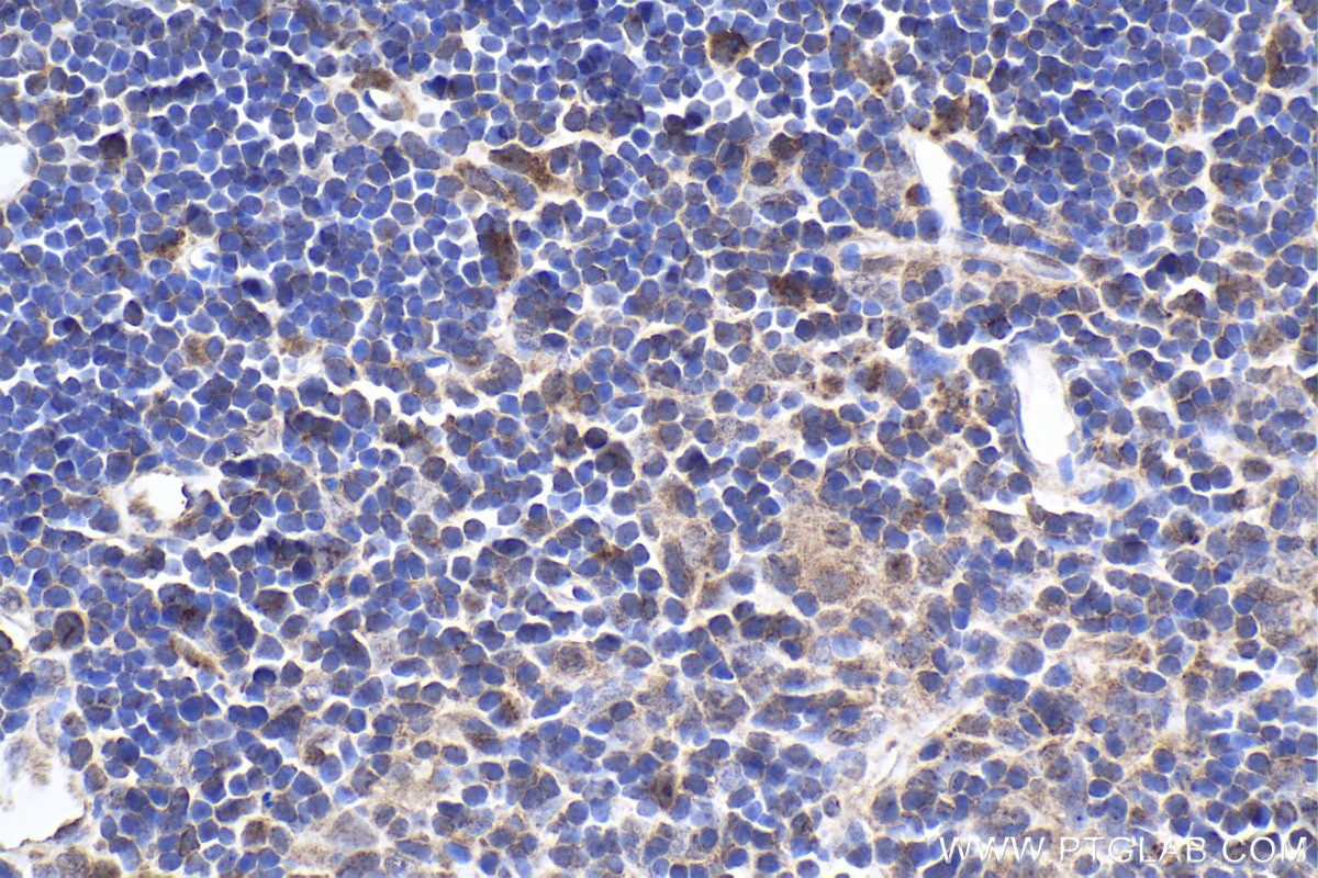 Immunohistochemical analysis of paraffin-embedded mouse thymus tissue slide using KHC1881 (NLRP3 IHC Kit).