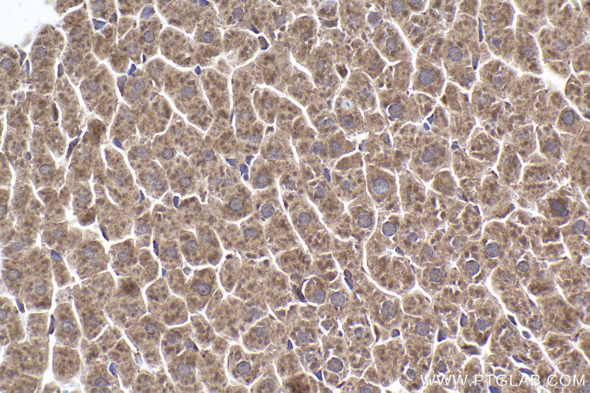 Immunohistochemical analysis of paraffin-embedded rat liver tissue slide using KHC1881 (NLRP3 IHC Kit).