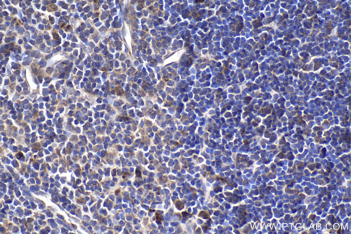 Immunohistochemical analysis of paraffin-embedded rat thymus tissue slide using KHC1881 (NLRP3 IHC Kit).