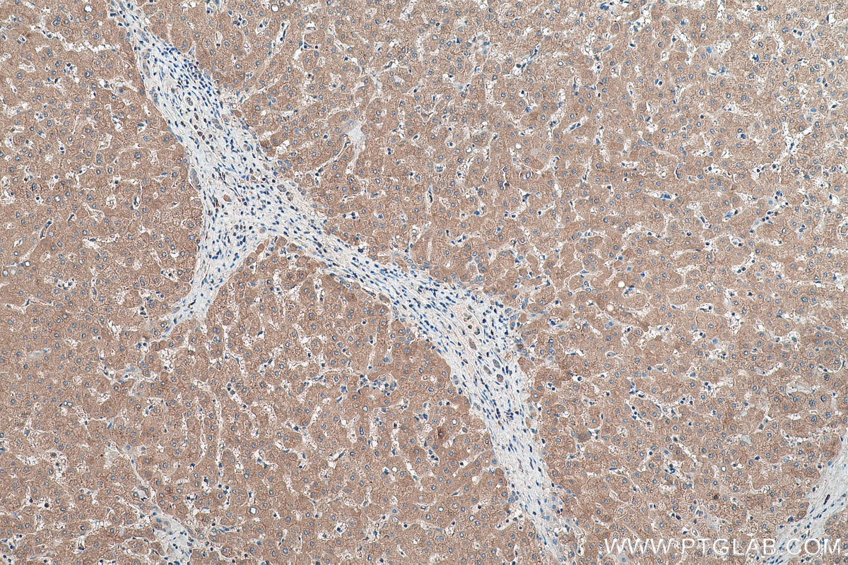 Immunohistochemical analysis of paraffin-embedded human liver tissue slide using KHC0442 (NME1 IHC Kit).