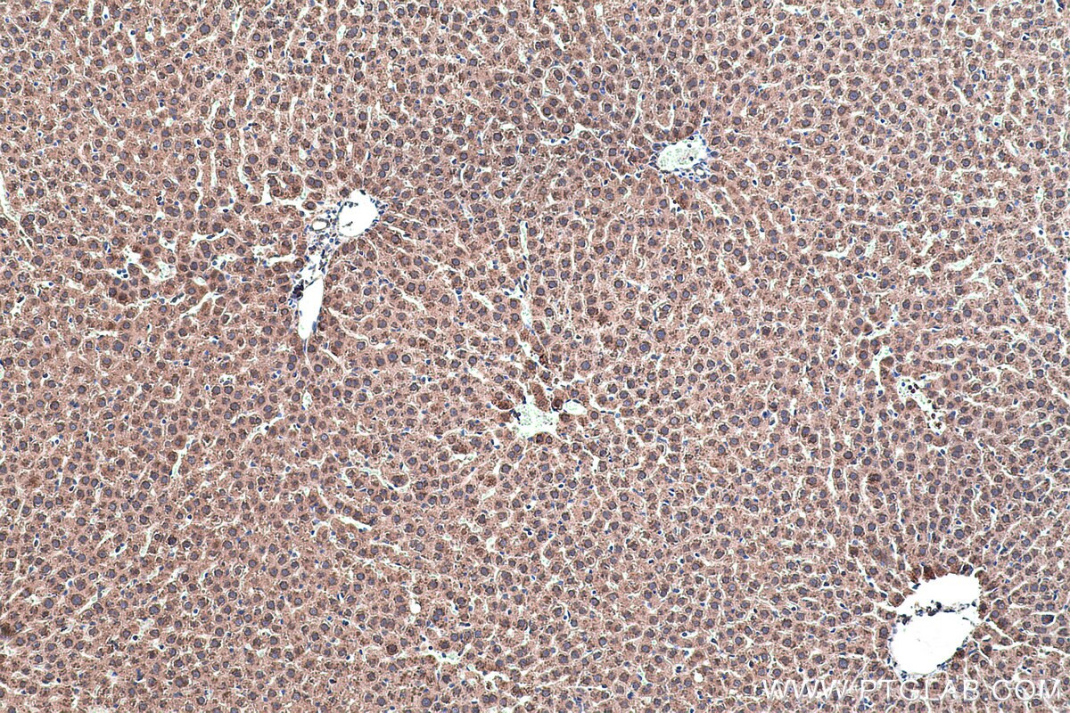 Immunohistochemical analysis of paraffin-embedded rat liver tissue slide using KHC0442 (NME1 IHC Kit).