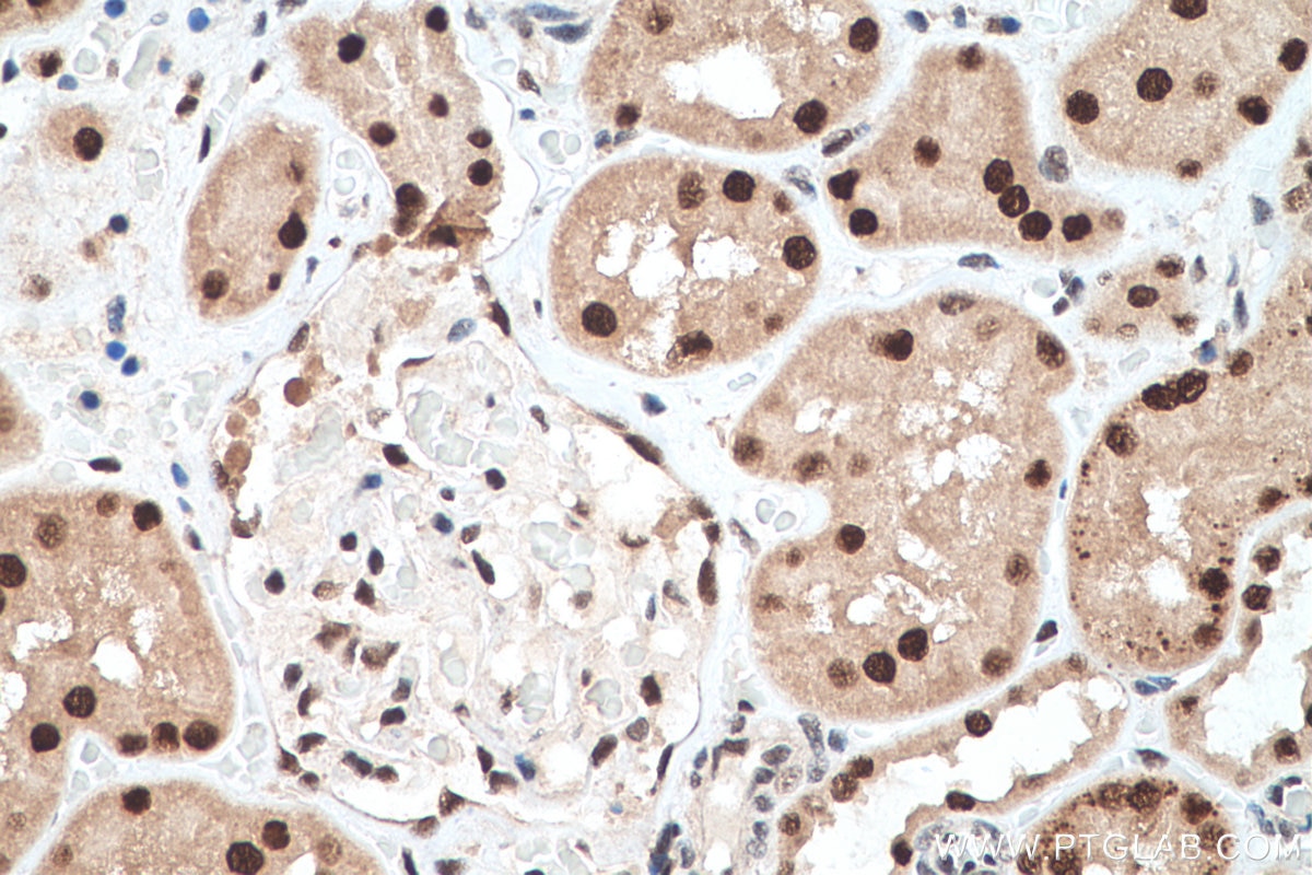 Immunohistochemical analysis of paraffin-embedded human kidney tissue slide using KHC0643 (NMNAT1 IHC Kit).