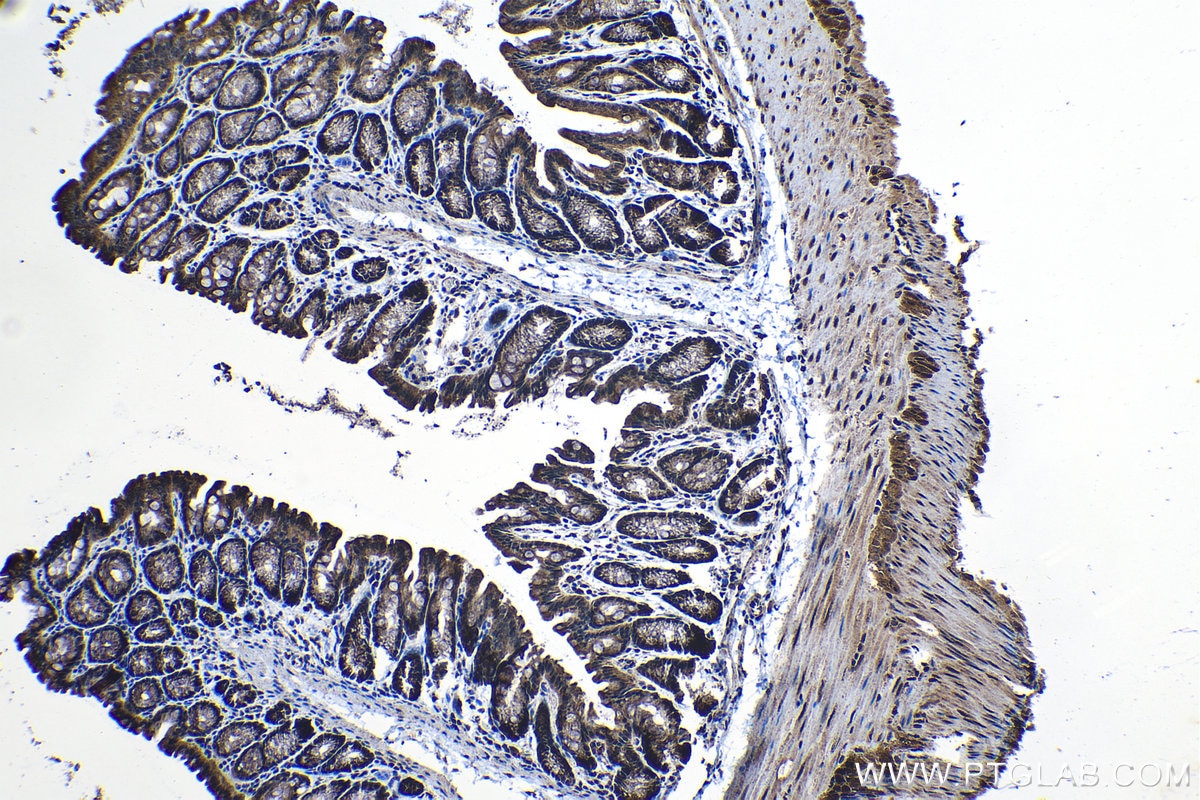 Immunohistochemical analysis of paraffin-embedded mouse colon tissue slide using KHC1257 (NMRAL1 IHC Kit).