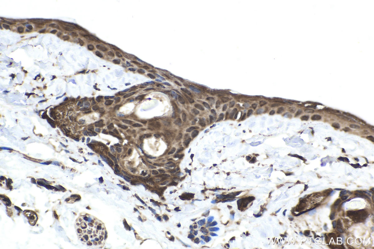 Immunohistochemical analysis of paraffin-embedded rat skin tissue slide using KHC1743 (NOLC1 IHC Kit).