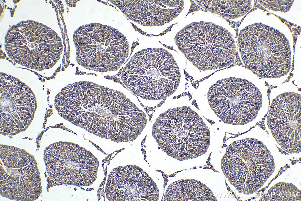 Immunohistochemical analysis of paraffin-embedded rat testis tissue slide using KHC1743 (NOLC1 IHC Kit).