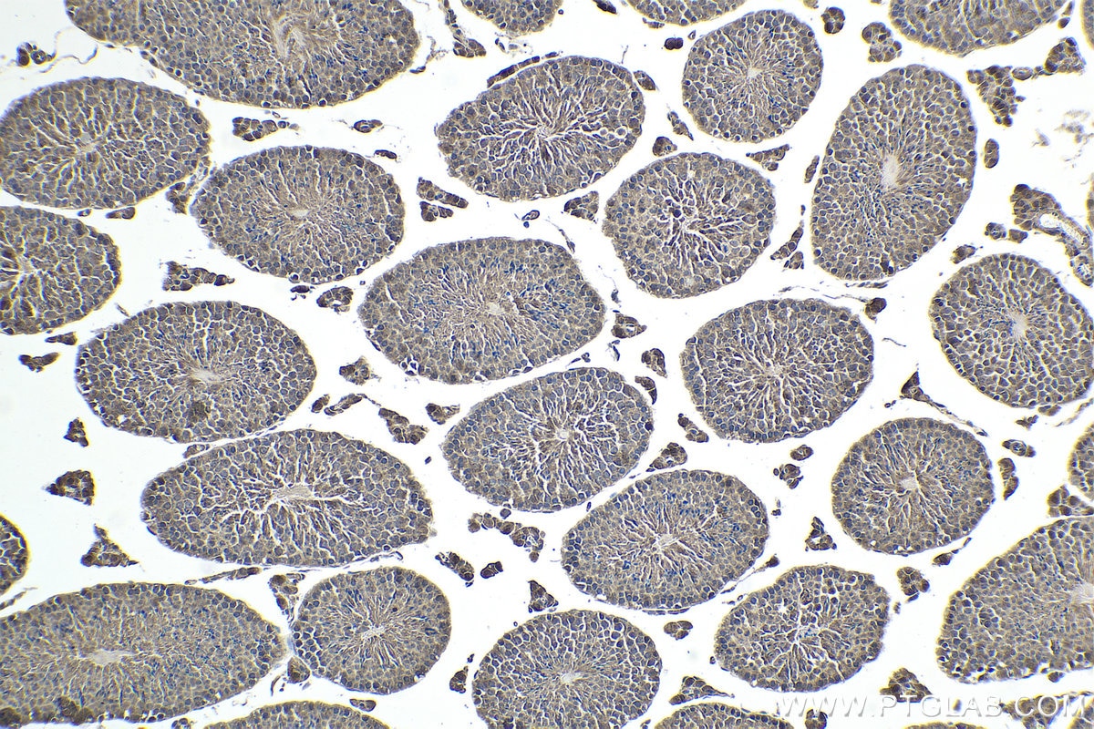 Immunohistochemical analysis of paraffin-embedded mouse testis tissue slide using KHC1743 (NOLC1 IHC Kit).