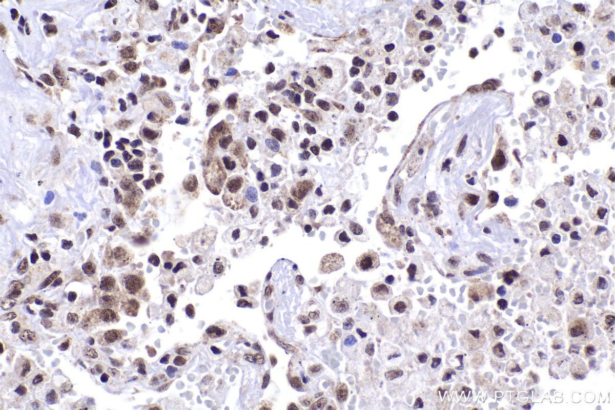 Immunohistochemical analysis of paraffin-embedded human lung tissue slide using KHC2017 (NOP58 IHC Kit).