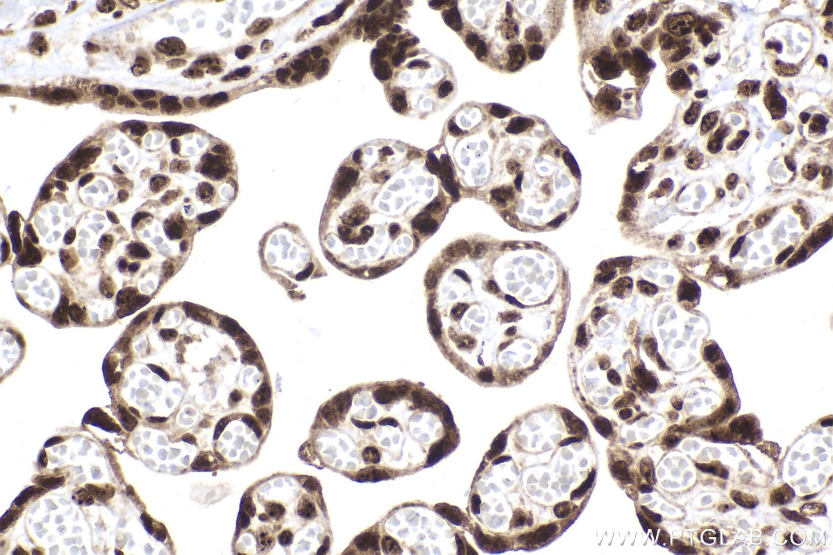 Immunohistochemical analysis of paraffin-embedded human placenta tissue slide using KHC2017 (NOP58 IHC Kit).