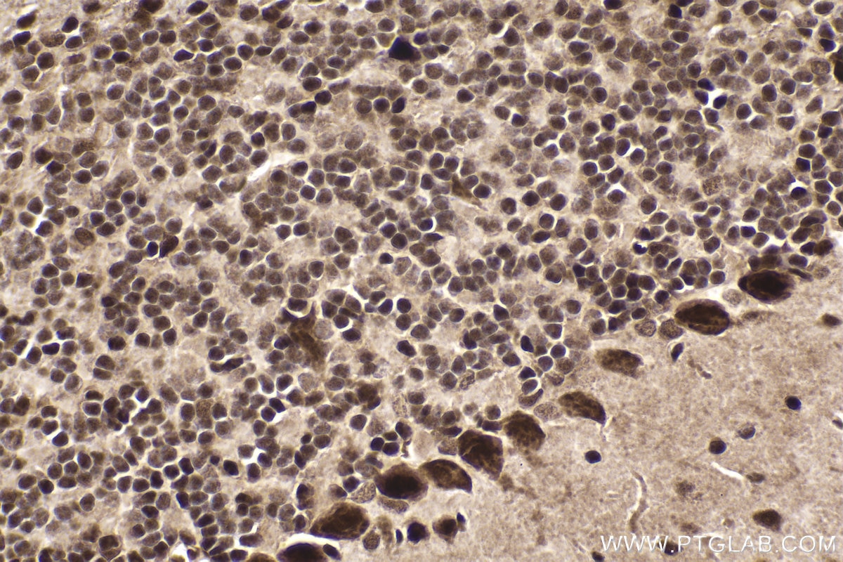 Immunohistochemical analysis of paraffin-embedded mouse cerebellum tissue slide using KHC2017 (NOP58 IHC Kit).