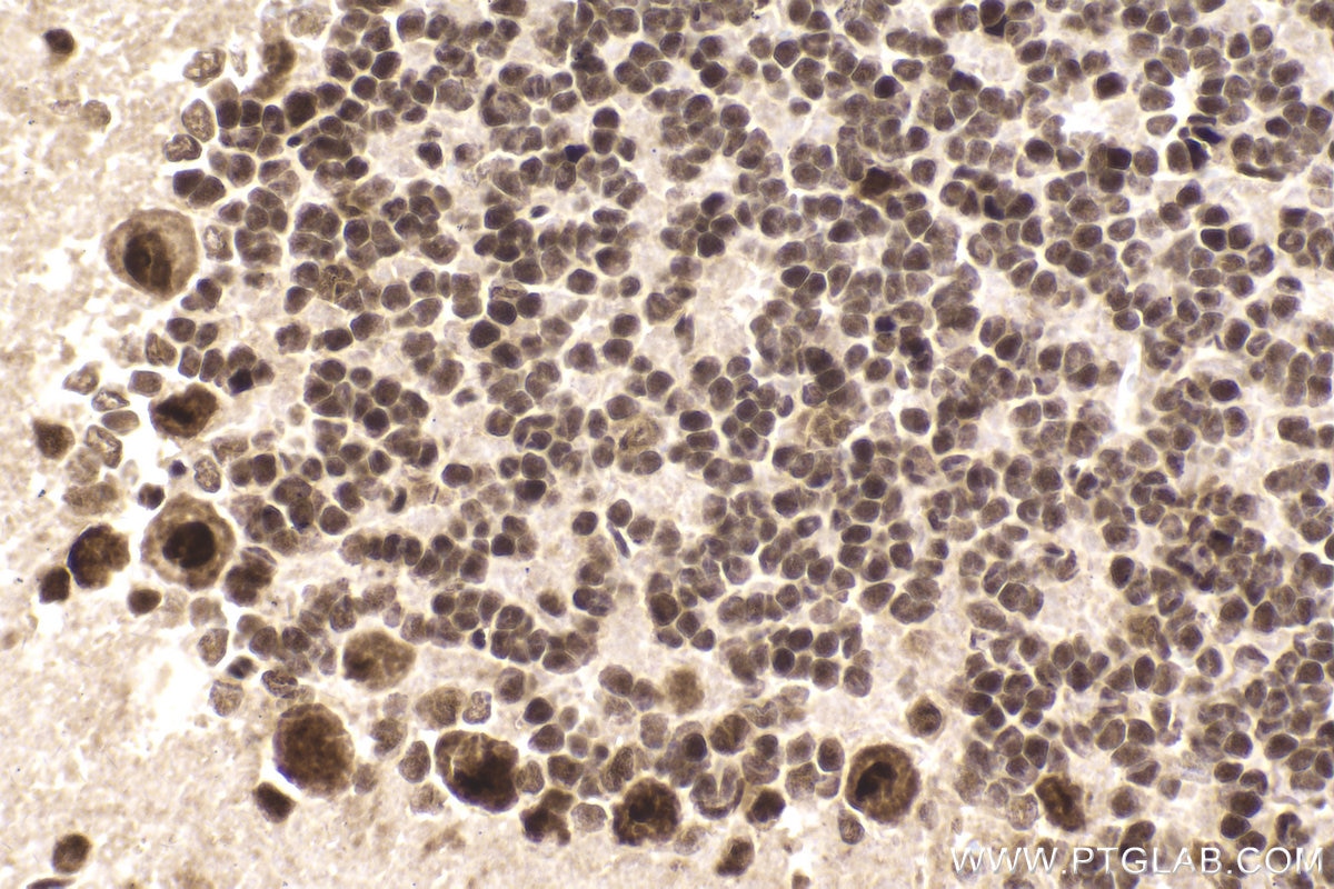 Immunohistochemical analysis of paraffin-embedded rat cerebellum tissue slide using KHC2017 (NOP58 IHC Kit).