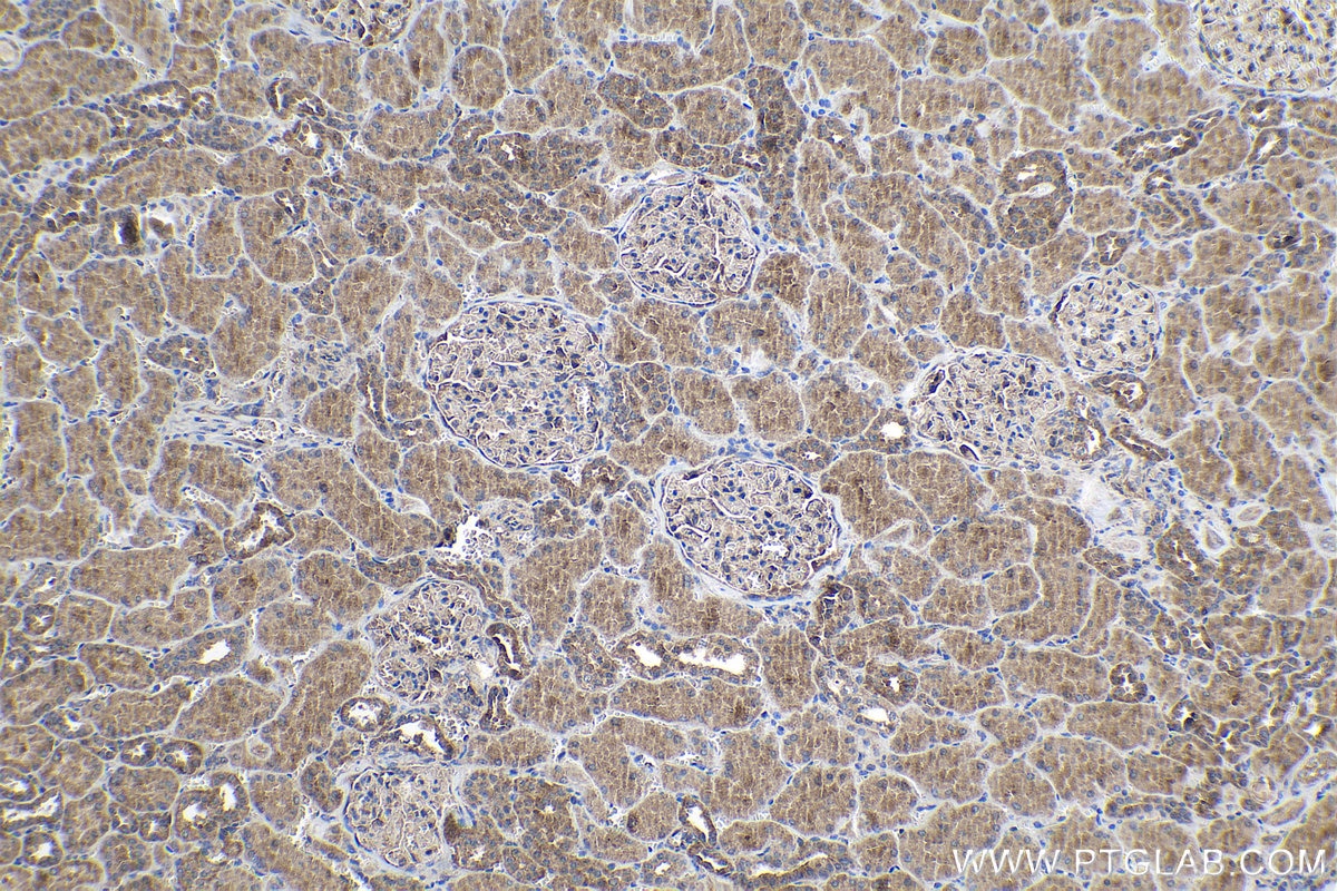 Immunohistochemical analysis of paraffin-embedded human kidney tissue slide using KHC1061 (NOTCH1 IHC Kit).