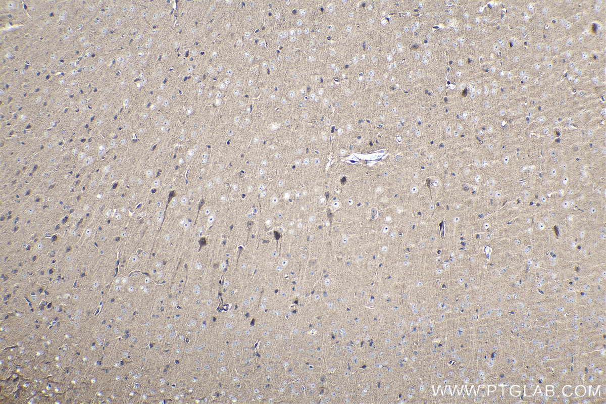 Immunohistochemical analysis of paraffin-embedded mouse brain tissue slide using KHC1061 (NOTCH1 IHC Kit).