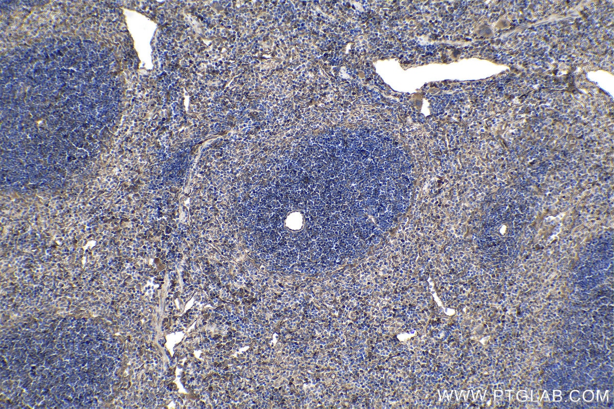 Immunohistochemical analysis of paraffin-embedded mouse spleen tissue slide using KHC1061 (NOTCH1 IHC Kit).